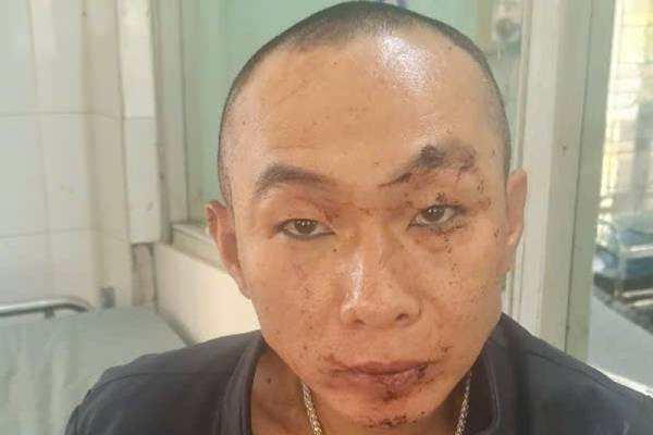 No sung ban tra canh sat khi bi phat hien tu tap su dung ma tuy hinh anh