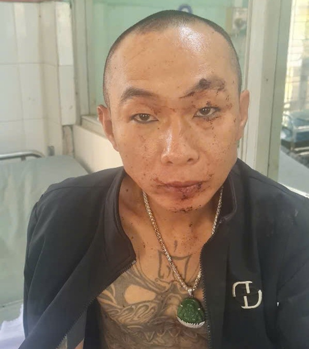 Su dung ma tuy anh 1