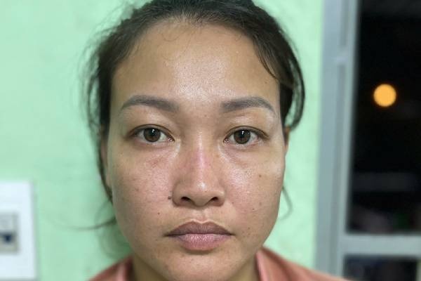 Khoi to nguoi phu nu danh nhan vien gac chan tau gay xuong mui hinh anh