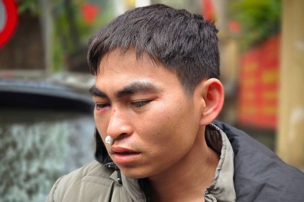 Ha Noi yeu cau xu ly nghiem vu nam shipper bi tai xe Lexus hanh hung hinh anh