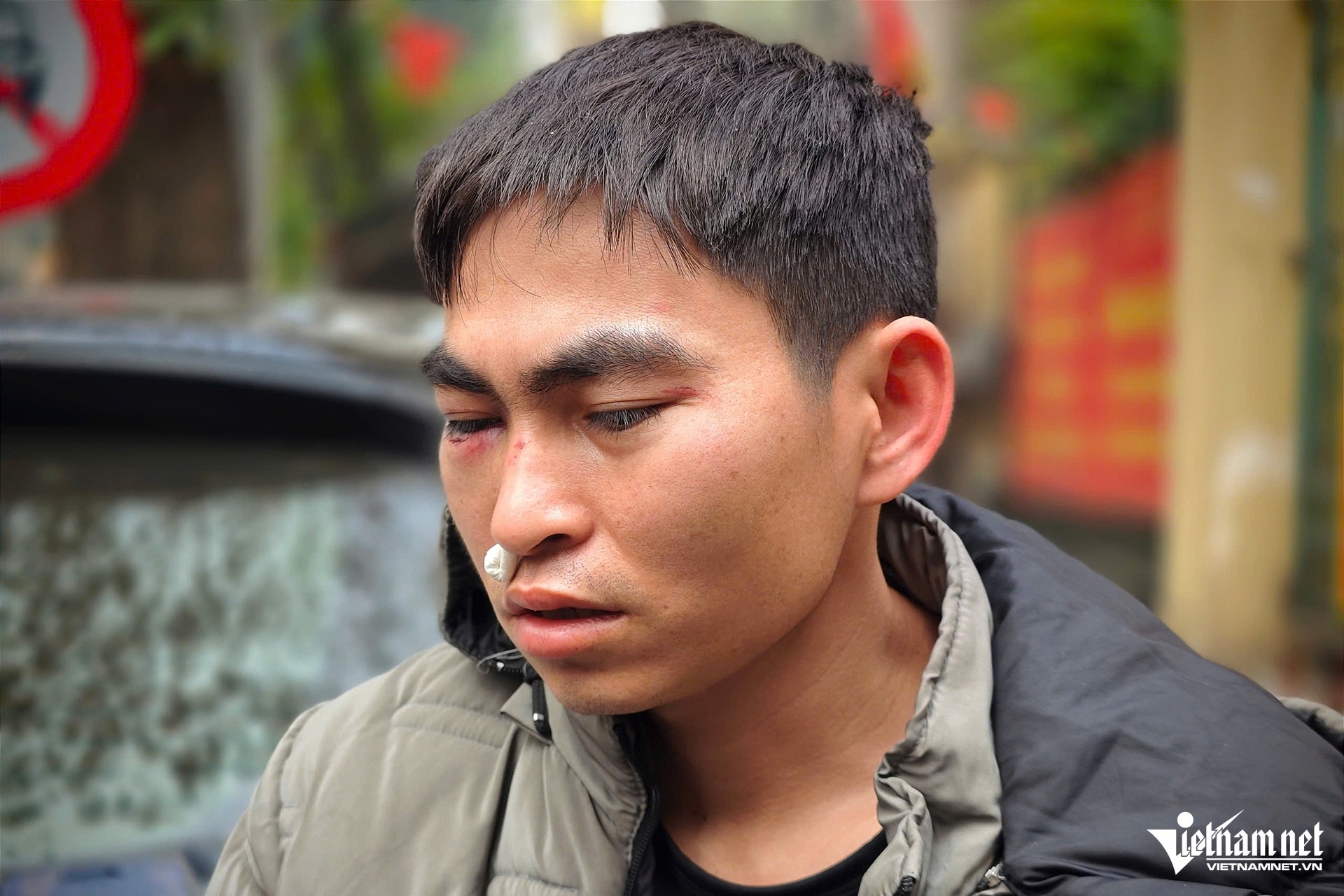 Nam shipper,  Bi hanh hung,  Tai xe Lexus anh 2