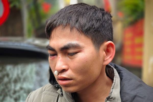 Vu nam shipper bi hanh hung: 2 vo chong moi den Ha Noi lam thue hinh anh