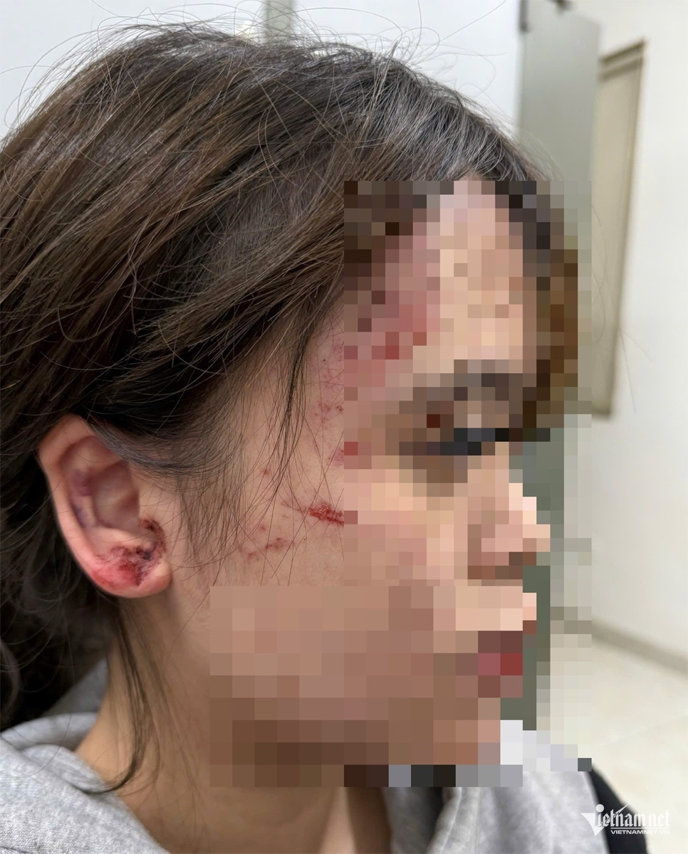 Hanh hung co gai anh 2