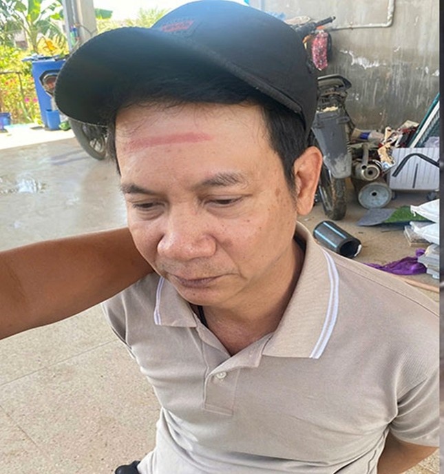 Duong day ma tuy anh 1