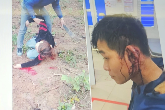 2 vo chong,  Bi danh toi tap,  Phai nhap vien anh 2