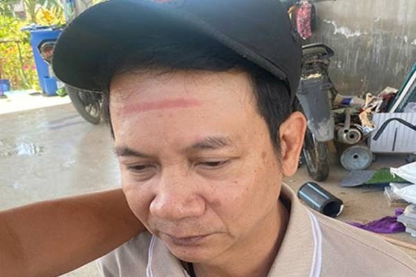 Bat doi tuong cam dau duong day ma tuy lien tinh hinh anh