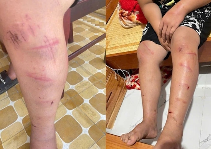 Xich chan hanh hung Hue anh 2