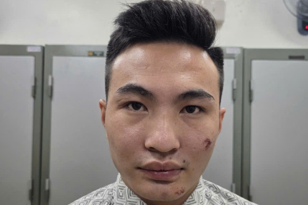 Tam giu doi tuong chong nguoi thi hanh cong vu tai chot bao ve A80 hinh anh