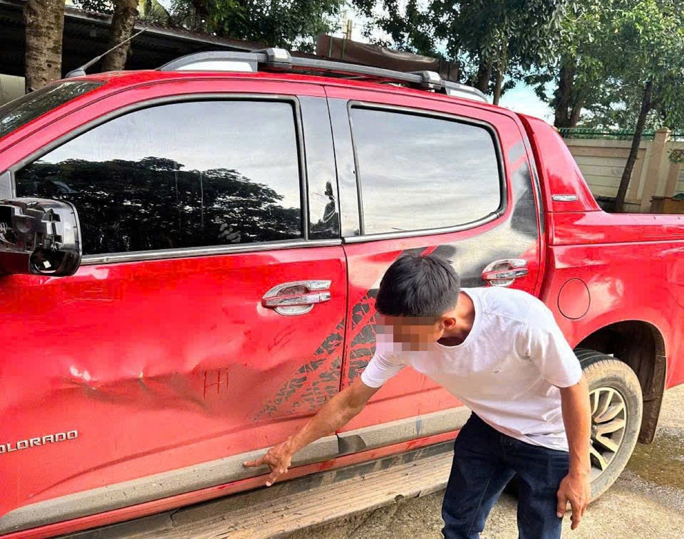 Vu nam sinh lop 11 nguy kich sau tai nan: Tai xe ra trinh dien hinh anh