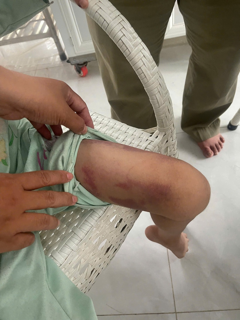 Be gai 9 tuoi,  Nguoi tinh cua me anh 1