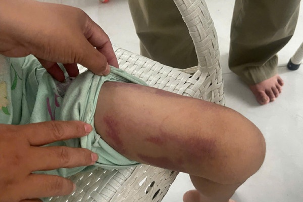 Be gai 9 tuoi bi nguoi tinh cua me bat nhung luoi vao nuoc soi hinh anh