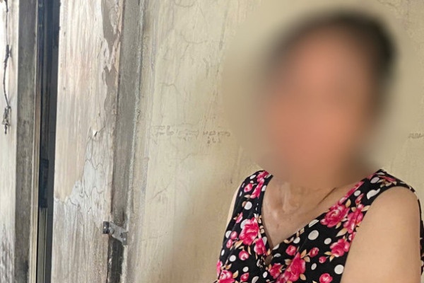 Mau thuan con dau, me chong tam xang dot can ho, 2 chau noi bi bong hinh anh