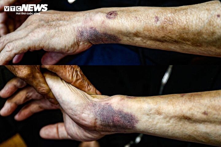 Doa giet hang xom anh 3