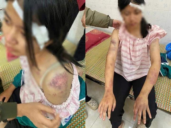 Me be gai,  bi bao hanh anh 2