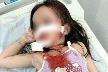 Be gai 4 tuoi bi cho tha rong tan cong hinh anh