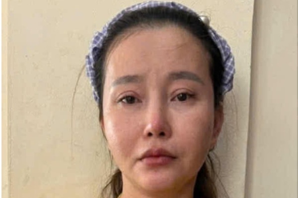 Nu bi can phau thuat tham my de tron truy na van khong thoat hinh anh