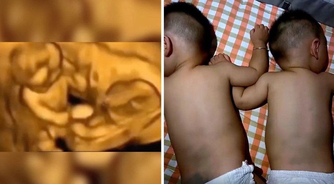 Cap song sinh bam tim anh 1