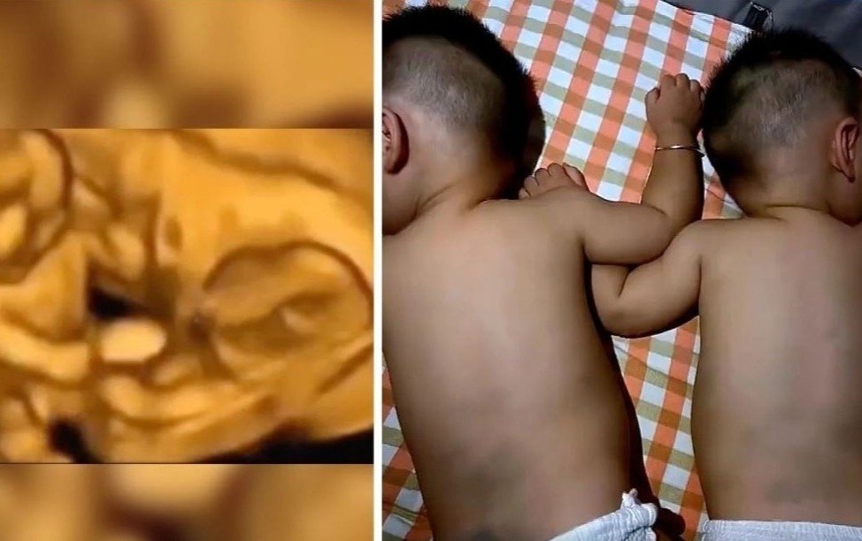 Clip cap song sinh dam nhau bam tim trong bung me chi la tro dua hinh anh