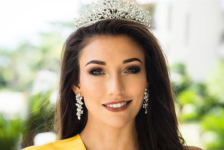 Nguoi mau 27 tuoi tro thanh Hoa hau Hoan vu Bi hinh anh