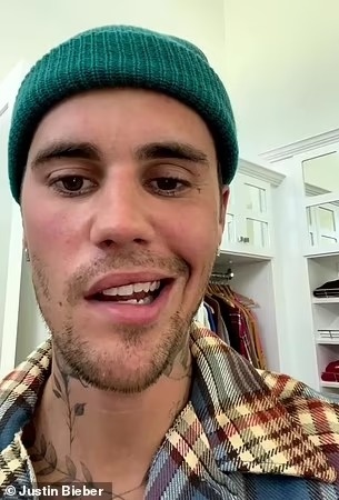 Justin Bieber liet co mat anh 1