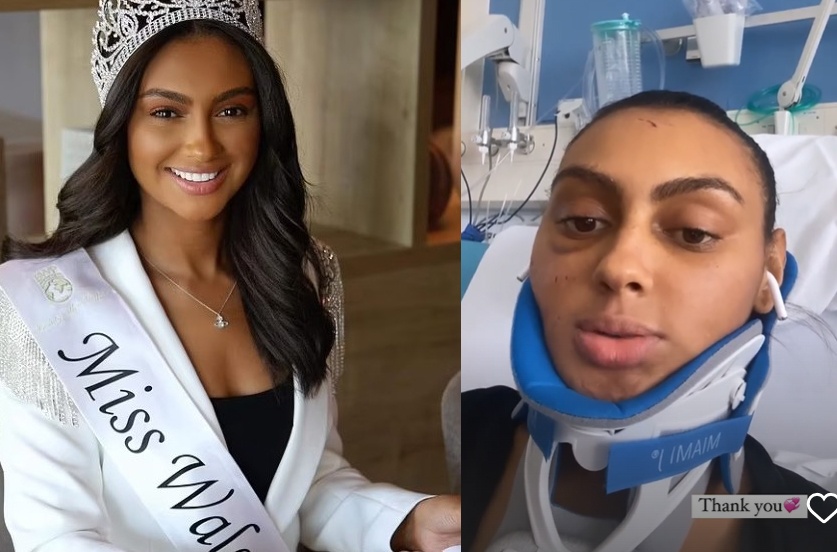 Hoa hau Wales hoi phuc sau tai nan nghiem trong hinh anh