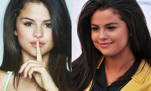 Sao dieu dung vi tang can khong kiem soat hinh anh