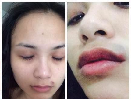 Sao Viet to bi chong thuong cang chan, ha cang tay hinh anh