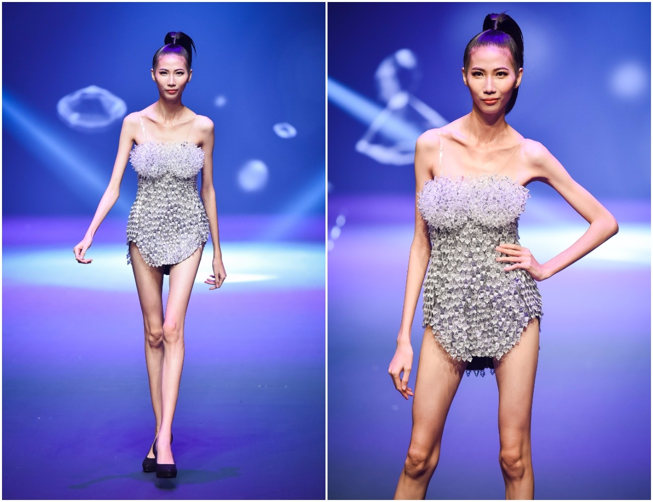 Cao Ngan gay da boc xuong: Tro cuoi hay thuc te dang so? hinh anh