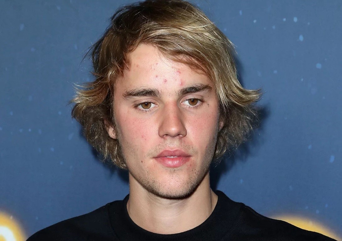 justin bieber ngay cang xau trai anh 12