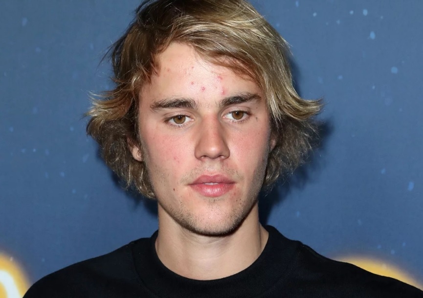 Justin Bieber lo mat day mun sau khi co tin don chia tay Selena Gomez hinh anh