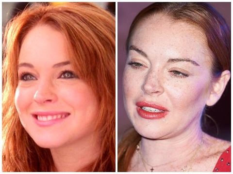 Lindsay Lohan: Ngoi sao nghien phau thuat tham my va gia coi o tuoi 32 hinh anh