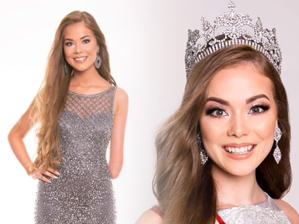 Co gai xinh dep mat tay bam sinh vao Top 25 Hoa hau Sieu quoc gia hinh anh