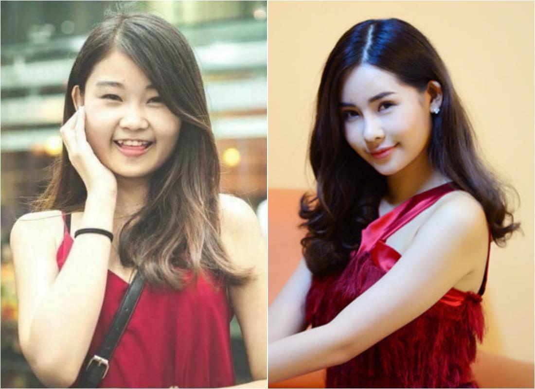 sao viet phau thuat tham my anh 6