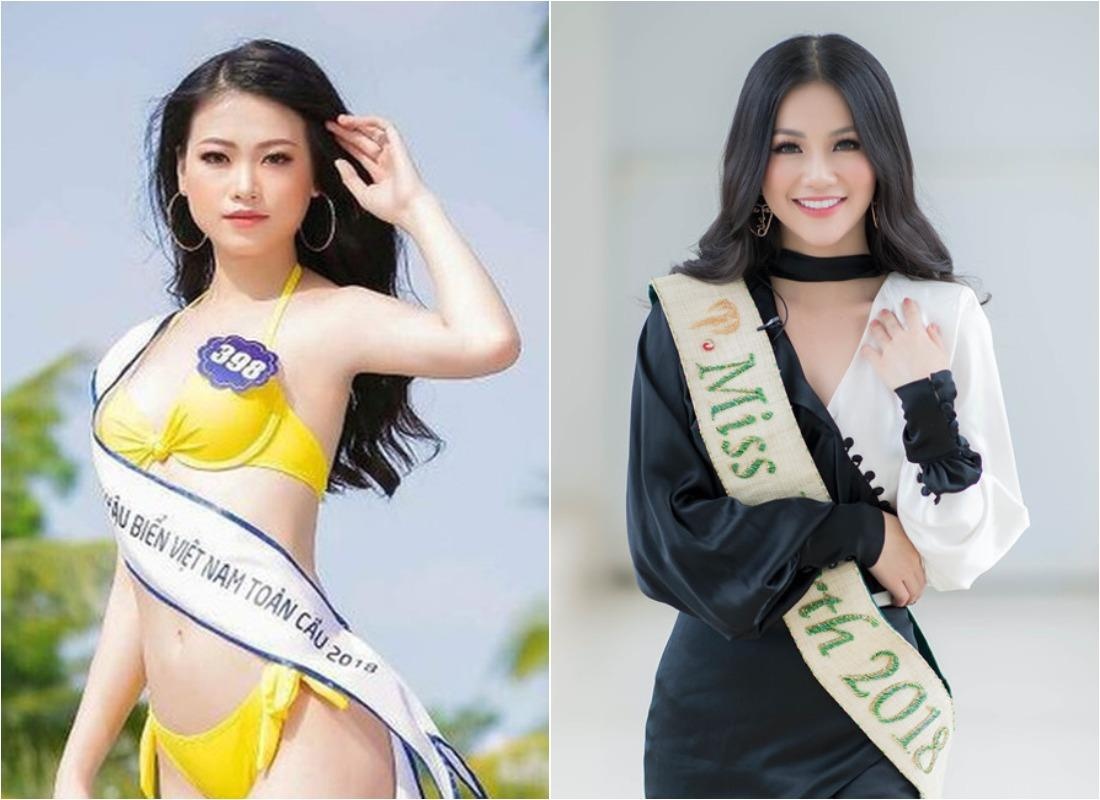 sao viet phau thuat tham my anh 4