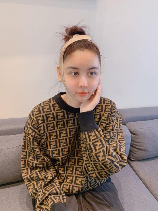 sao viet cong khai phau thuat tham my anh 12