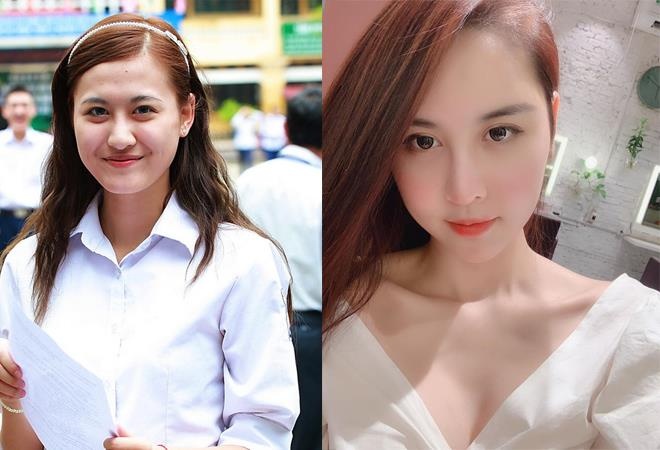 sao viet cong khai phau thuat tham my anh 13