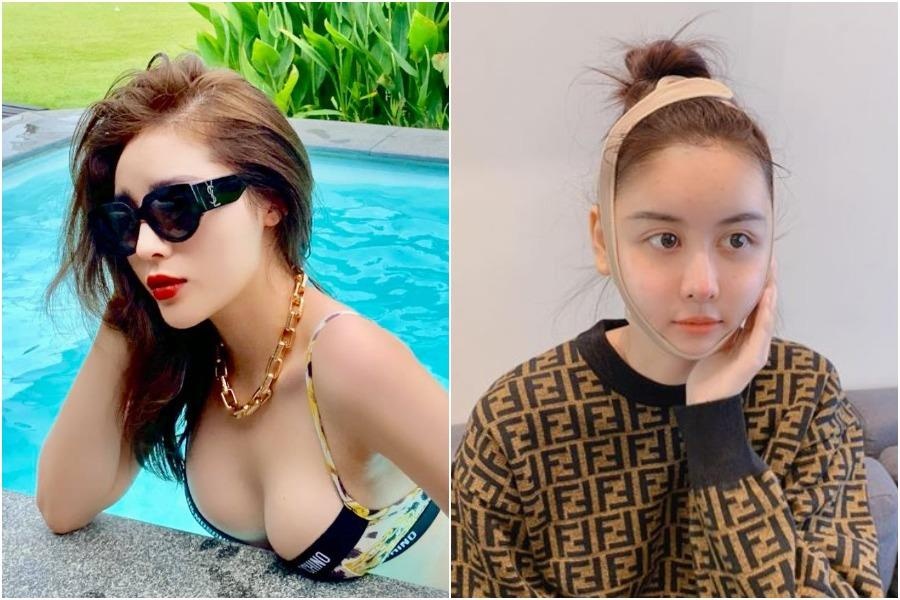 Nho dau sao Viet tu hao khoe viec dao keo, khong con xau ho giau giem? hinh anh