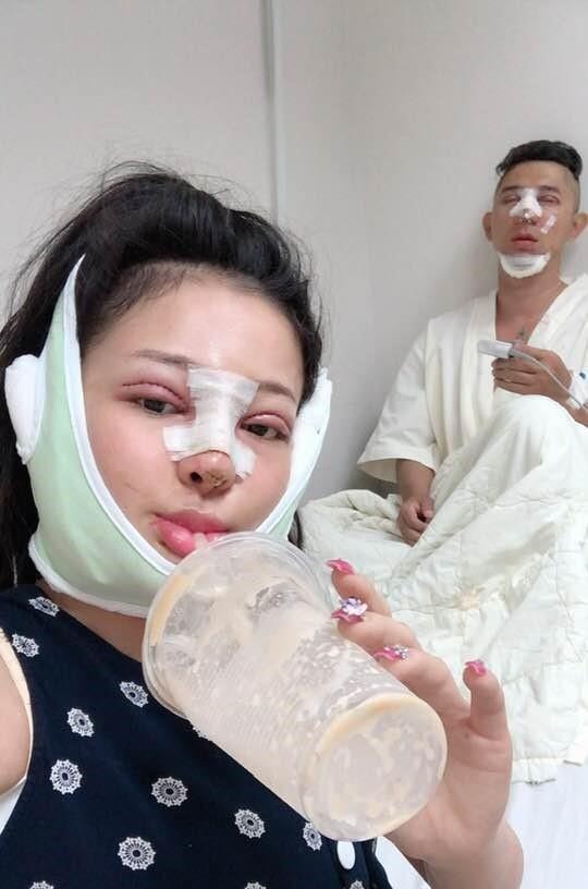 sao viet cong khai phau thuat tham my anh 11