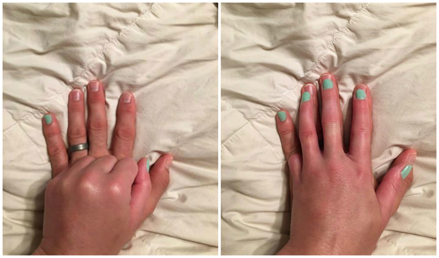 Anh la ngon tay ut cua em anh 1