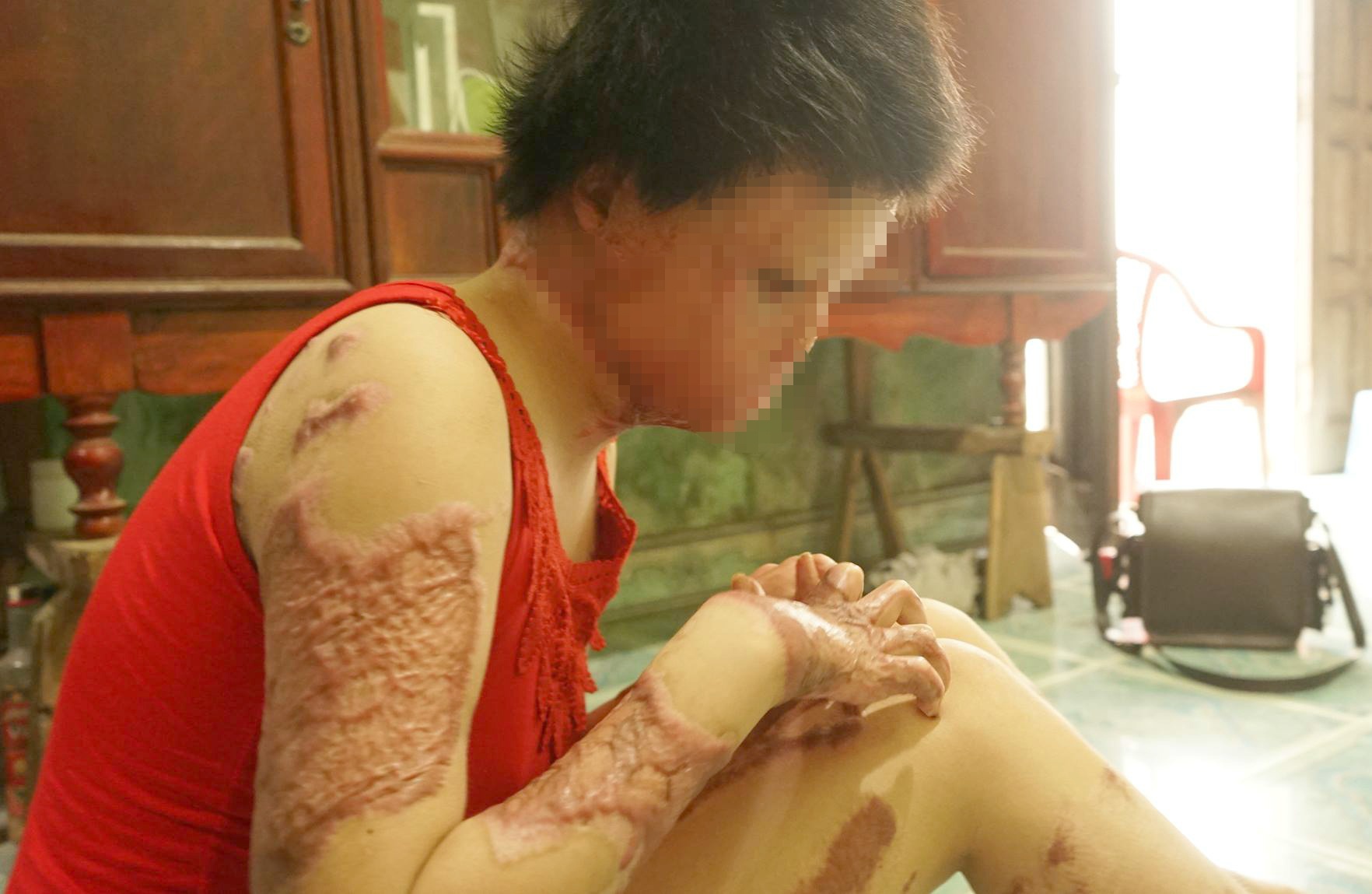 Chong tuoi xang dot vo: Nuoc mat roi vi lua chon sai lam hinh anh