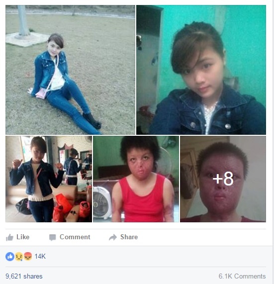 Chồng tưới xăng đốt vợ ảnh 2 Chong tuoi xang dot vo anh 2