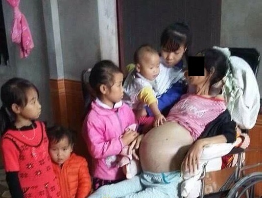Gia dinh 6 chi em mo coi me, bo mac benh mat tri nho hinh anh