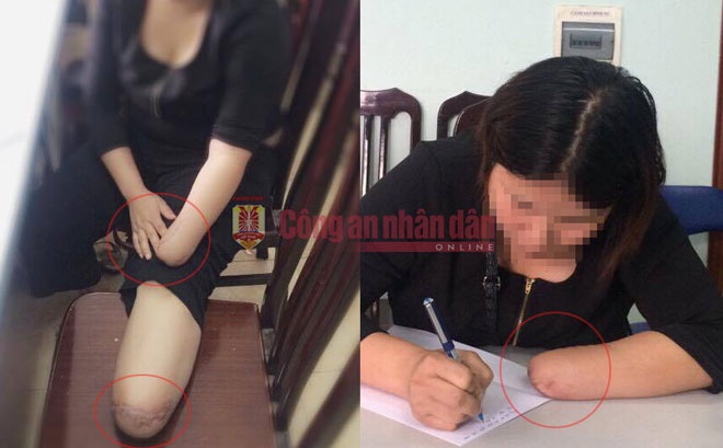 Chat chan tay lay tien bao hiem anh 2