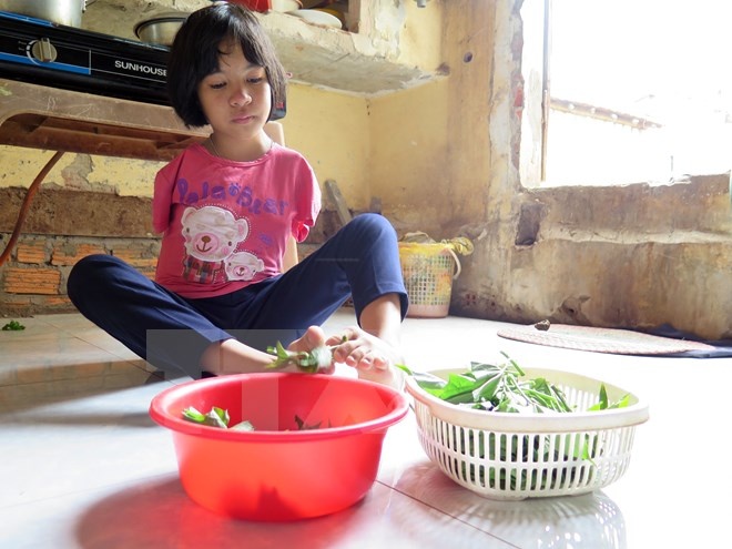 đa khuyết tật bẩm sinh ảnh 2 da khuyet tat bam sinh anh 2