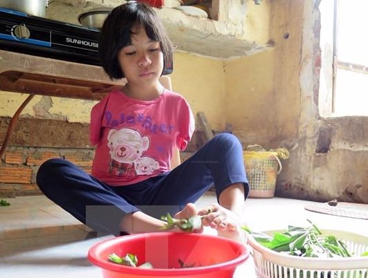 Nghi luc song cua co be da khuyet tat bam sinh o Kon Tum hinh anh