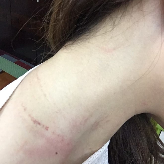 Nữ nhân viên bị đánh ảnh 1 Nu nhan vien bi danh anh 1