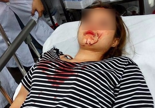 Xac minh thong tin cong an danh ban gai vi khong dap lai tinh cam hinh anh