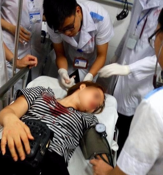 công an đánh bạn gái ảnh 2 cong an danh ban gai anh 2