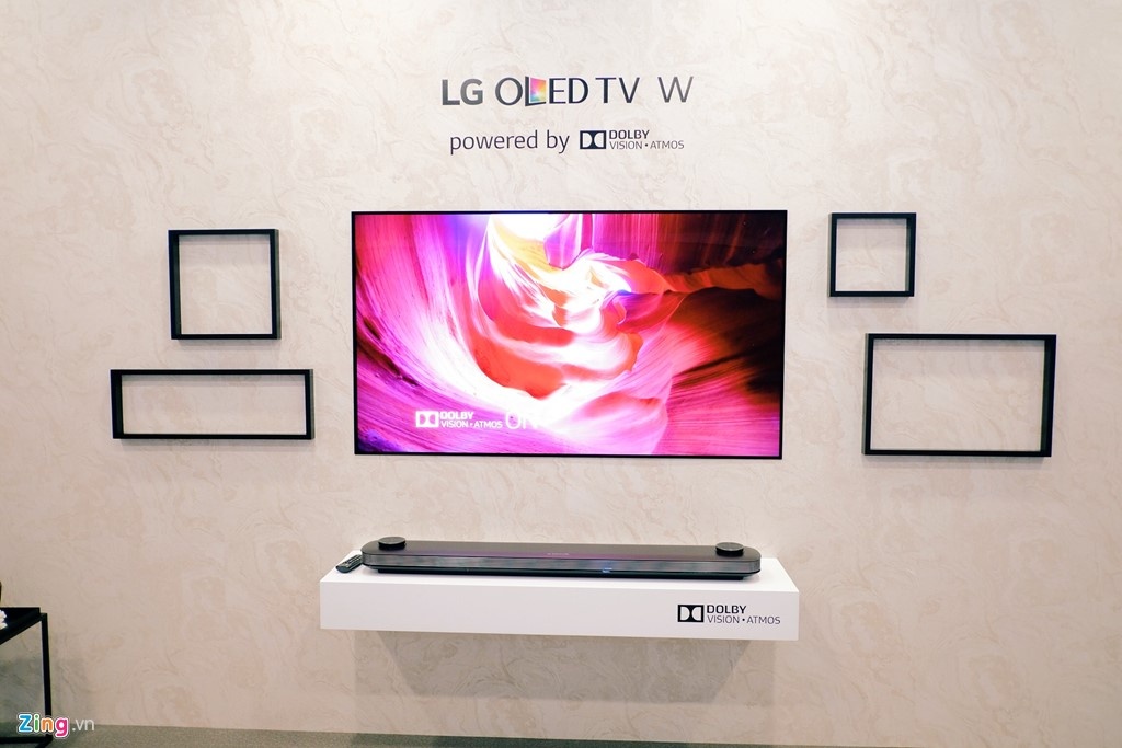 LG ảnh 1 LG anh 1