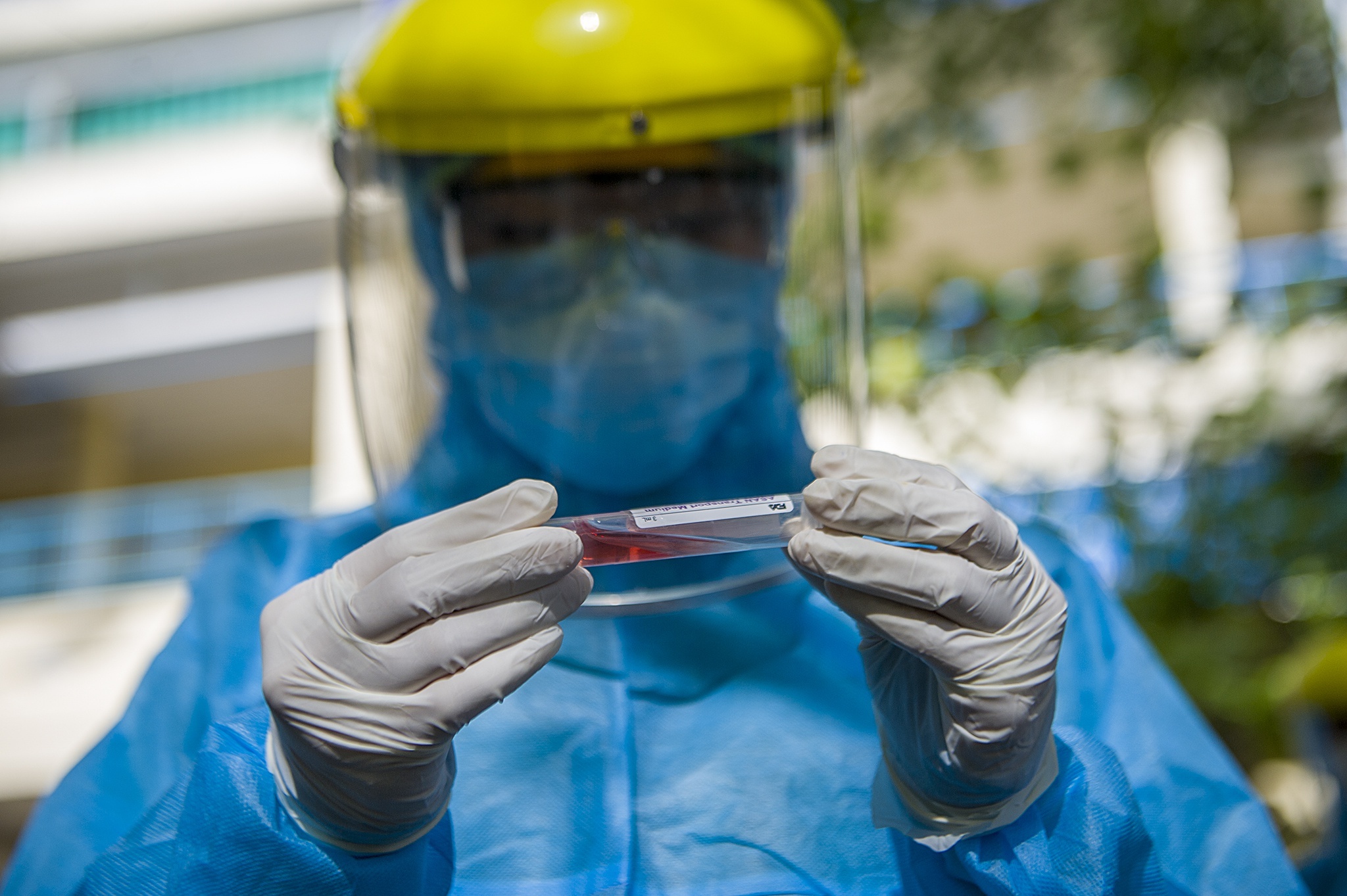 Chi phi chong dich Covid-19 cua Viet Nam chua den 400 trieu USD hinh anh